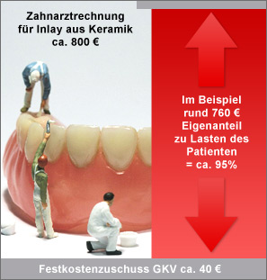 Grafik über Festkostenzuschuss im Vergleich zum eigenanteil